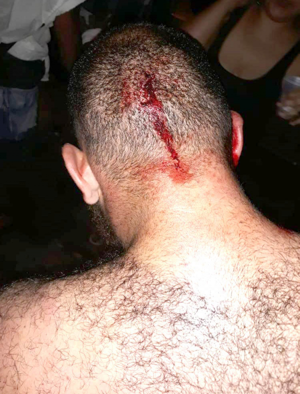 Rapaz foi atingido com garrafas de vidro