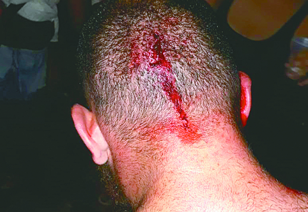 Rapaz agredido por usar bon\u00e9 do MST