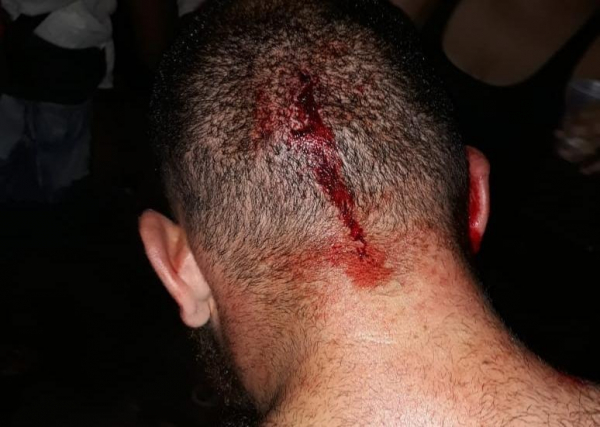 Na segunda-feira, jovem com bon\u00e9 do MST foi agredido em Curitiba