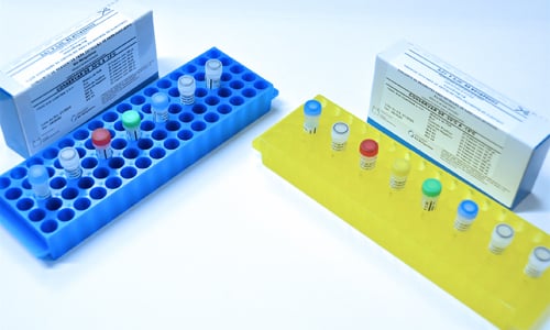 Kit de identificação do coronavírus desenvolvido na Fiocruz