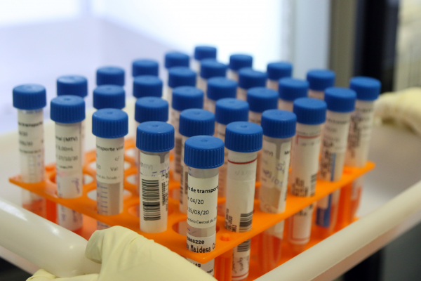 Tendência de queda pode ser verificada em todas cidades da RMC