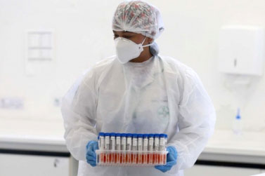 Testes da fase 3 da vacina podem começar entre este mês e o próximo