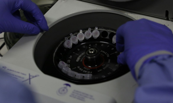 Casos suspeitos passam por exames laboratoriais para descarte ou confirmação
